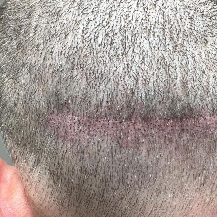  - Scalpology - Scalp Micropigmentation in PA - Scalp Micropigmentation - SERVICES -  -  - Scalpology - Scalp Micropigmentation in PA - Scalp Micropigmentation - SERVICES -  - 